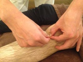膝関節への鍼治療